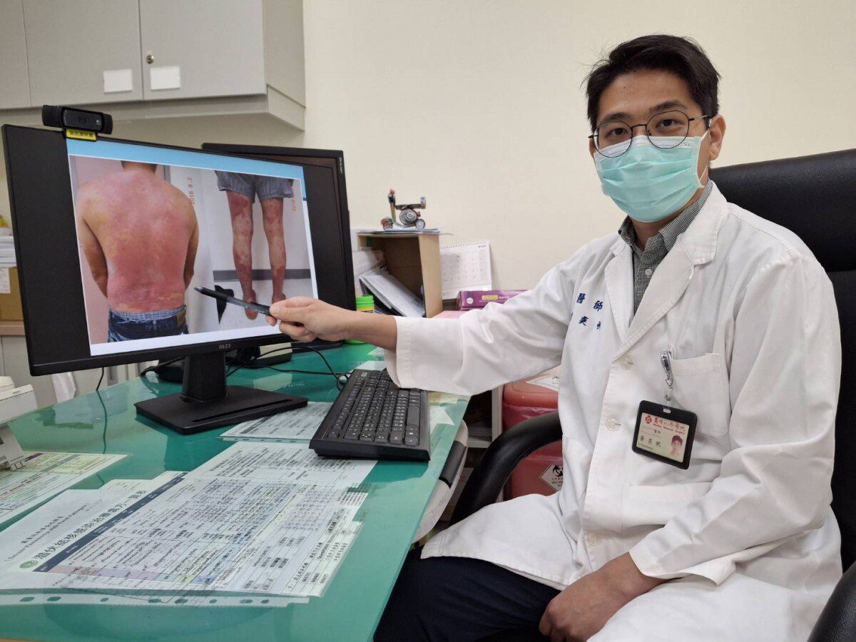 身上乾癬伴隨關節疼痛 可能是免疫系統敵我不分 嚴重要換關節