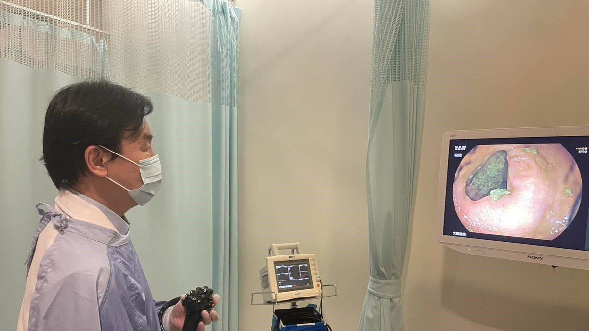 AI輔助大腸鏡提升早期癌篩精準度