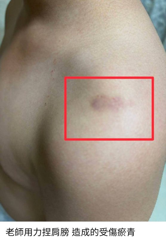 漾新聞|疑遭導師不當管教 高市某國中事件引關注 教育局:零體罰、零容忍 漾新聞|疑遭導師不當管教 高市某國中事件引關注 教育局:零體罰、零容忍