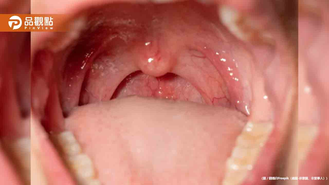 手機2分鐘揪口腔癌！台大AI快篩準確率破95％ 2027年臨床應用