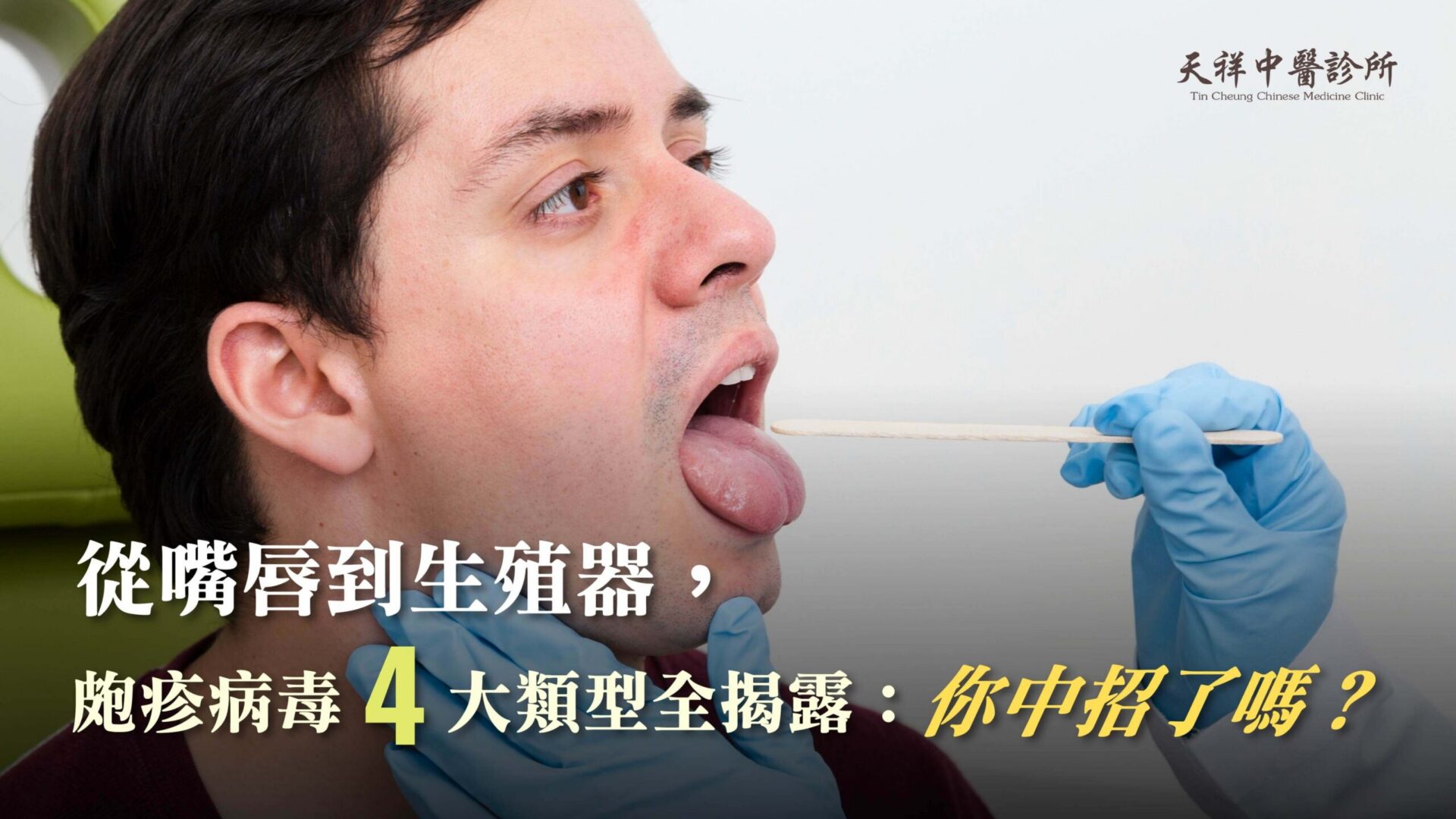 從嘴唇到生殖器，皰疹病毒 4 大類型全揭露：你中招了嗎？